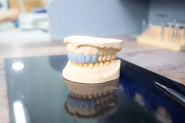 Modelo Mandíbula Mesa Clínica Dental Odontología Digital Moderna — Foto de Stock
