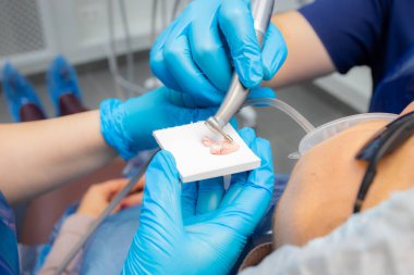 Profesyonel diş temizliği, özel bir macun ve fırça kullanarak..