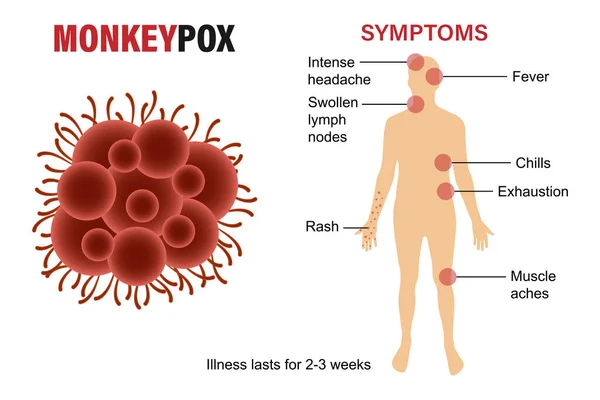 Banner Monkey Pox Virus Inform Warn Symptoms Monkey Virus Vector — Stock Vector
