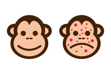 Çizgi film maymun virüsü ya da maymun çiçeği. Bulaşıcı hastalık. Maymun suratlı. Vektör sembolü veya çiçek hastalığı maymun simgesi.