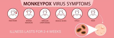 Symptoms of the monkey pox virus.  Monkey pox is spreading. This causes skin infections. Infographic of symptoms of the monkey pox virus clipart