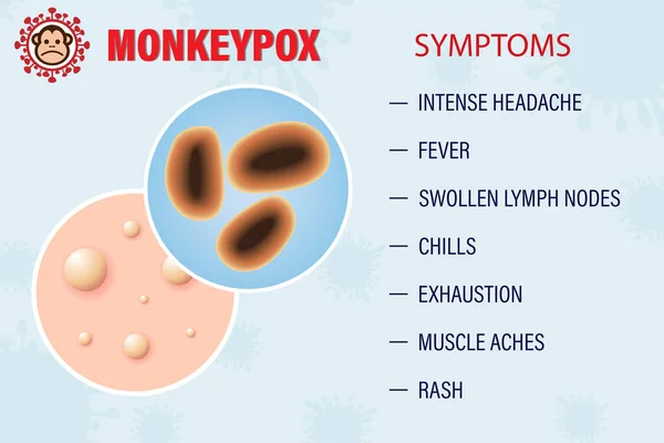 Banner Monkeypox Virus Inform Warn Symptoms Monkey Virus Vector Illustration — Stock Vector