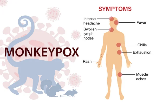 Sintomas Vírus Varíola Macaco Vírus Epidêmico Espalha Animais Como Macacos — Vetor de Stock