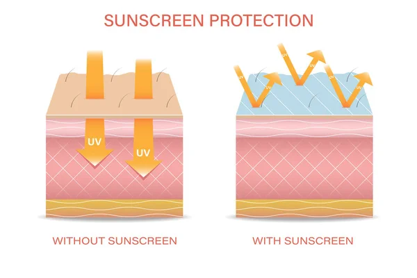 자외선 복사로부터 피부를 Damaged Human Skin Exfoliates Sun Protection Fatty — 스톡 벡터