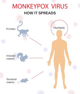 Infographics of the spread of monkeypox disease. Flat vector illustration.