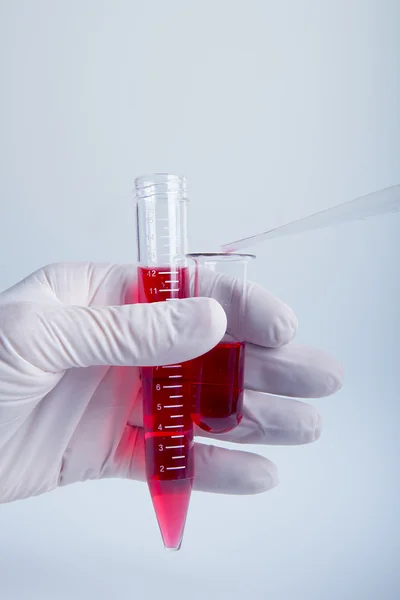 血液生化分析。塑料实验室设备与血液分析. — 图库照片