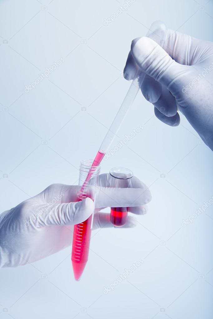 Biochemistry of blood tests.  Plastic labware with blood analysis.