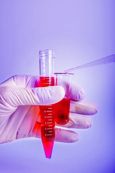 Biochemie krevních testů. plastová zařízení laboratorní analýzou krve. — Stock fotografie