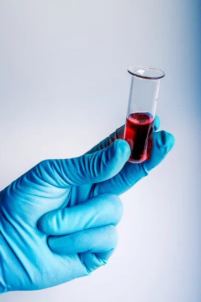 Cientista que trabalha no laboratório bioquímico. Análise bioquímica do sangue . — Fotografia de Stock