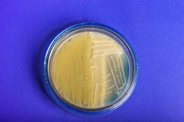 Petri dish with  bacteria (Streptococcus) on  agar. clipart