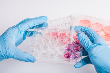 biyokimyasal analiz için plaka eldivenli ellerini tutun. bilimsel araştırma için plastik laboratuvar donatımı.