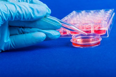 eldivenli elini tutmak için kan analizi pipet. bilimsel araştırma için plastik laboratuvar donatımı.