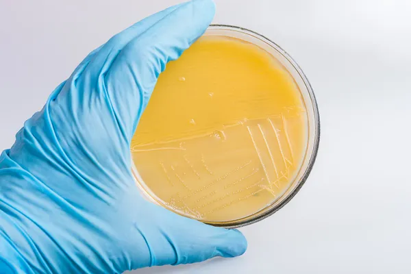 Gehandschoende hand houden de plaat met bacteriën streptococcus voor analyse. — Stockfoto