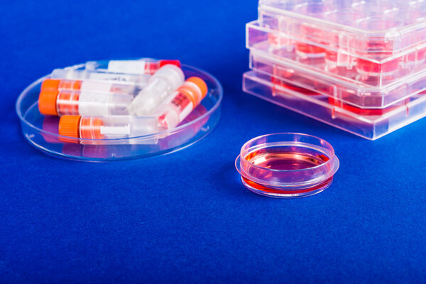 Labware Petri dishes and tubes. Human stem cells in biomedical scientific laboratory.