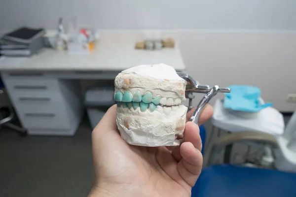 Modelowanie Sztucznych Zębów Modelu Gipsu Wyświetlania Wizualnego — Zdjęcie stockowe