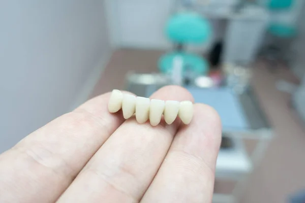 Mosty Ceramiki Dentystycznej Rękach Doktryny — Zdjęcie stockowe