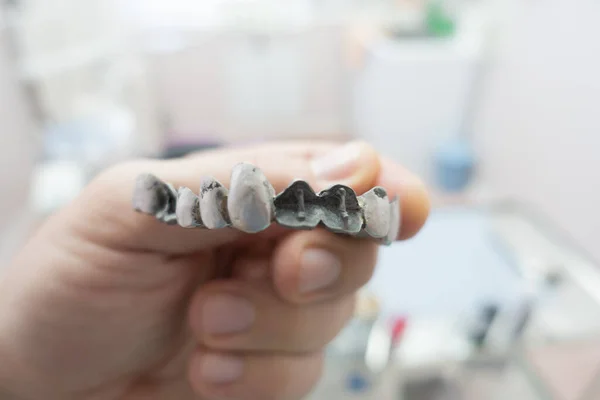 Metal Dental Bridge Manufacturing Process — Stock Photo, Image