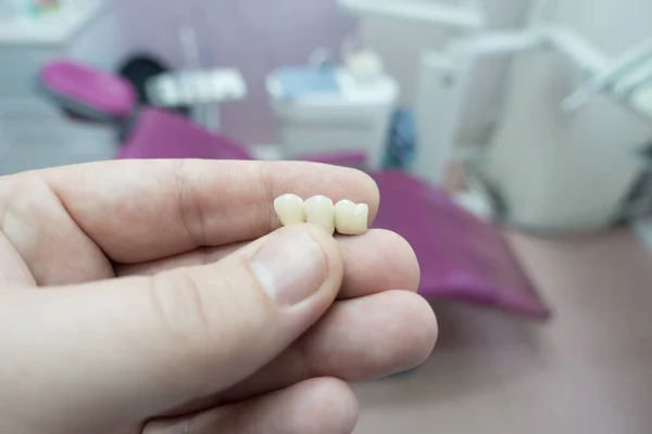 dental ceramic metal bridges in the hands of a docto