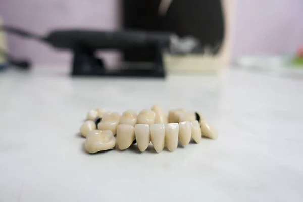 Dentystyczne Mosty Ceramiczne Metalowe Stole — Zdjęcie stockowe