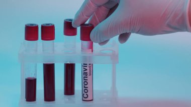 cropped view of scientist in latex glove taking test tube with blood sample and coronavirus lettering on blue 