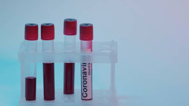 test tubes with blood sample and coronavirus lettering on blue 