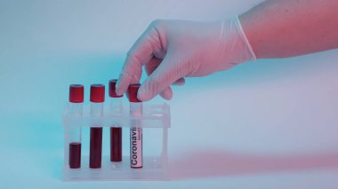 cropped view of scientist taking test tube with blood sample and coronavirus lettering from test tube rack on blue 