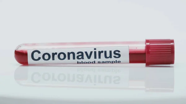 Close Test Tube Coronavirus Lettering Blood Sample White — 图库照片