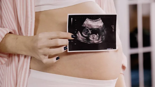 Cropped view of pregnant woman holding ultrasound scan of baby near belly — Stock Photo