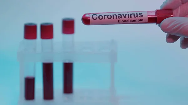 Частковий погляд вченого, що тримає пробірку з аналізом крові та коронавірусом, що розпилюється на синьому — стокове фото