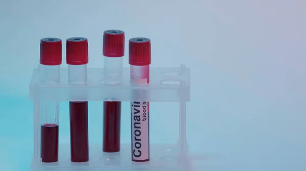 Test tubes with blood sample and coronavirus lettering on blue — стоковое фото