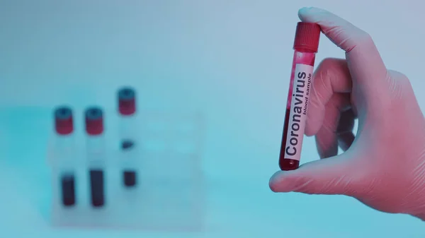 Partial view of scientist in latex glove holding test tube with blood sample and coronavirus lettering on blue — Photo de stock