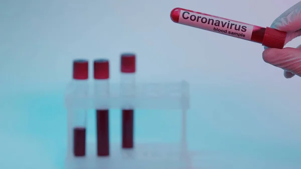 Partial view of scientist in latex glove holding blood sample and coronavirus lettering on blue — Stock Photo