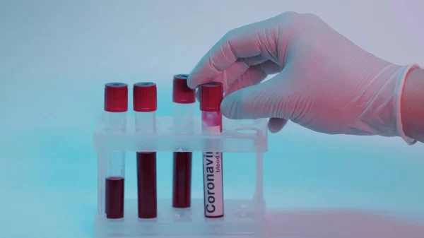 Partial view of scientist in latex glove taking test tube with blood sample and coronavirus lettering on blue — Photo de stock