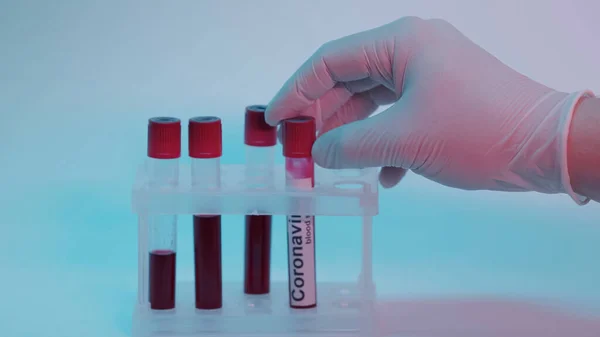 Partial view of scientist in latex glove taking test tube with blood sample and coronavirus lettering on blue — стоковое фото