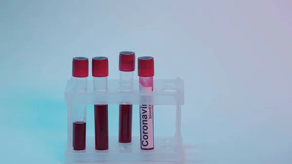 Test tubes with blood sample and coronavirus lettering on blue background — стоковое фото