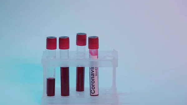 Test tubes with blood sample and coronavirus lettering on blue background — Stock Photo