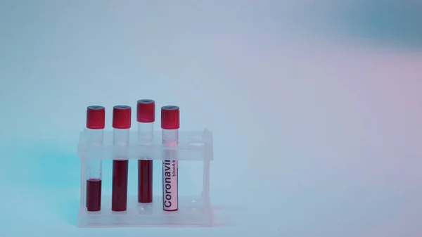 Test tubes with blood samples with coronavirus lettering inside of test tube rack on grey and blue background — стоковое фото
