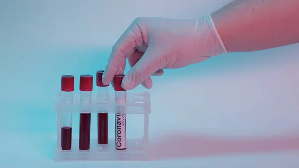 Cropped view of scientist taking test tube with blood sample and coronavirus lettering from test tube rack on blue — стоковое фото