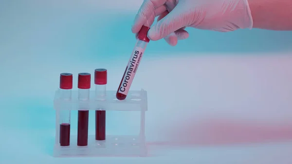 Partial view of scientist in latex glove taking test tube with blood sample and coronavirus lettering on blue — Photo de stock