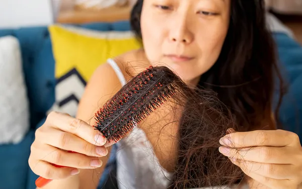 Wanita Asia Muda Sangat Kesal Dengan Rambut Rontok — Stok Foto