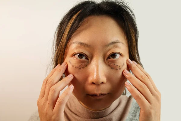 Göz Altı Torbalı Asyalı Kadın Göz Torbası Gösteren Kızın Şişkin — Stok fotoğraf