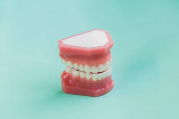 Braçadeiras Invasoras Retentor Invisível Dente Medicamente Precisa — Fotografia de Stock