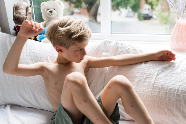 Su çiçeği olan çocuk, ateşler içinde yatağında oturuyor.