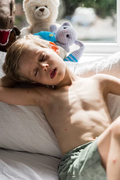 Toddler Boy Holding Toy Boy Chicken Pox Lying Bed — Zdjęcie stockowe