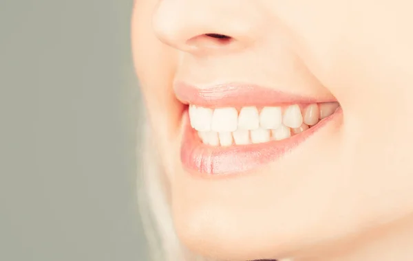 Teeth Whitening. Dental health Concept. Teeth whitening procedure. Dental care. Dentistry concept. Perfect healthy teeth. Closeup shot of womans toothy smile. Perfect healthy teeth smile woman — Stock Photo, Image
