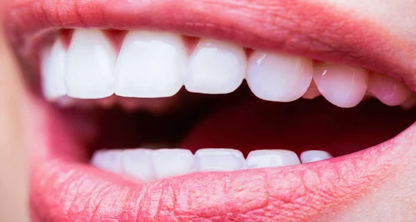 Cuidados dentários. Conceito de Odontologia. Dentes saudáveis perfeitos. Tiro de perto de sorrisos de dentes de mulher. Dentes saudáveis perfeitos sorrir mulher. Branqueamento dos dentes. Dental health Concept. Procedimento de clareamento dos dentes — Fotografia de Stock