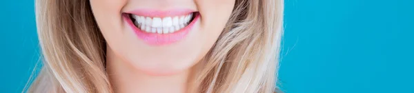 Denti sani perfetti. Primo piano colpo di donne dente sorriso. Perfetti denti sani sorridono donna. Sbiancamento dei denti. Concetto di salute dentale. procedura di sbiancamento dei denti. Cure dentali. Concetto odontoiatrico — Foto Stock