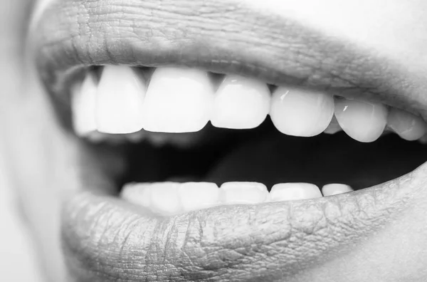 Postup Bělení Zubů Zubařská Péče Zubní Koncept Perfektní Zdravé Zuby — Stock fotografie