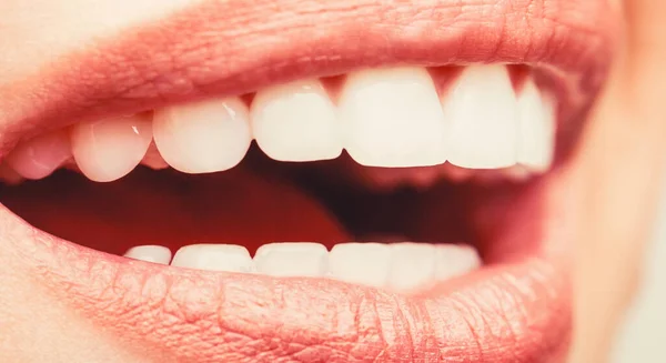 Teeth Whitening Procedure Dental Care Dentistry Concept Perfect Healthy Teeth — Zdjęcie stockowe