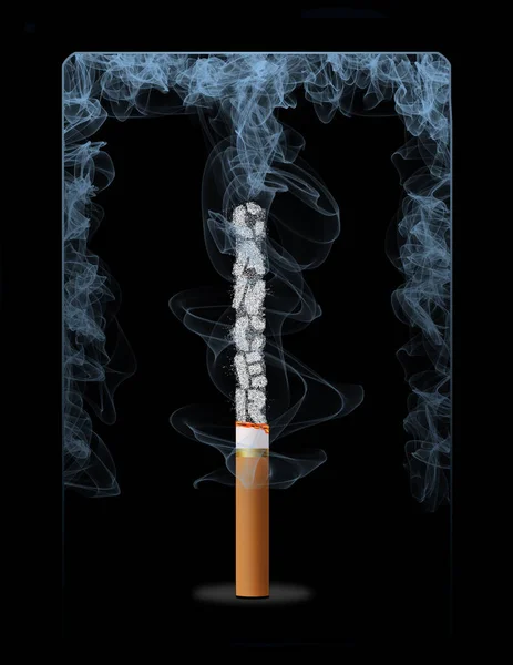 Cenizas Cigarrillo Humeante Deletrean Palabra Cáncer Esta Una Ilustración —  Fotos de Stock